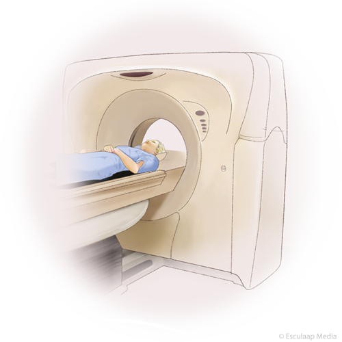 Maagkanker diagnostiek FDG pet CT scan