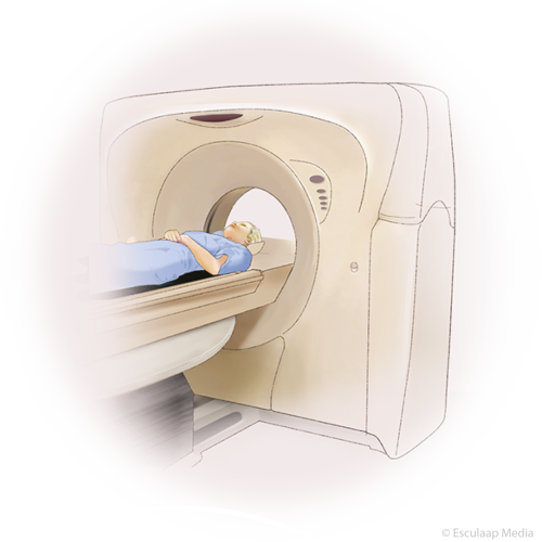 Slokdarmkanker FDG CT scan